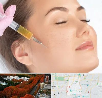 آموزش تزریق ژل و بوتاکس در منطقه 6 تهران 