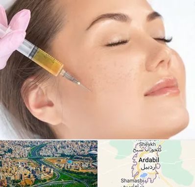 آموزش تزریق ژل و بوتاکس در اردبیل