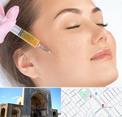 آموزش تزریق ژل و بوتاکس در مصلی مشهد