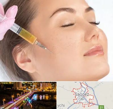 آموزش تزریق ژل و بوتاکس در سقز