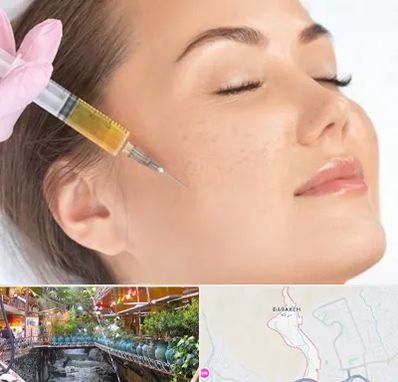 آموزش تزریق ژل و بوتاکس در درکه