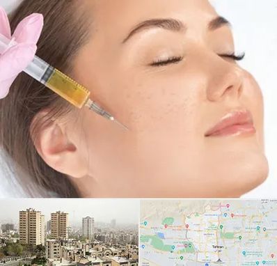 آموزش تزریق ژل و بوتاکس در منطقه 5 تهران 