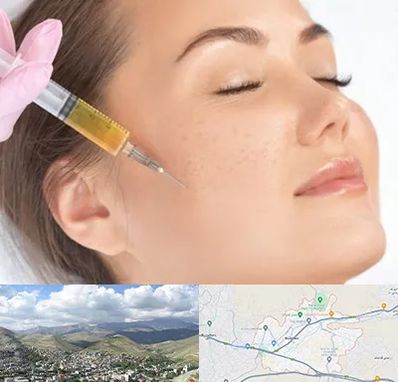 آموزش تزریق ژل و بوتاکس در رودهن