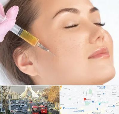 آموزش تزریق ژل و بوتاکس در خیابان آزادی 