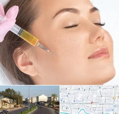 آموزش تزریق ژل و بوتاکس در ضیابری رشت 