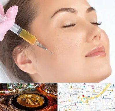 آموزش تزریق ژل و بوتاکس در میدان ولیعصر 