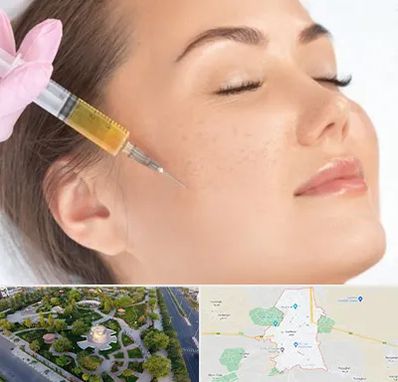 آموزش تزریق ژل و بوتاکس در کاشمر