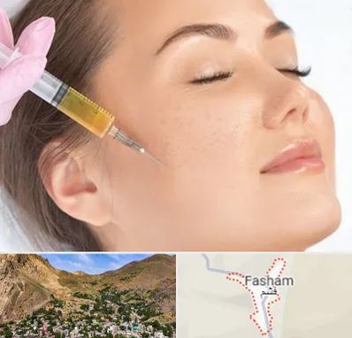 آموزش تزریق ژل و بوتاکس در فشم