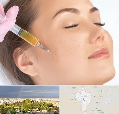 آموزش تزریق ژل و بوتاکس در تربت حیدریه