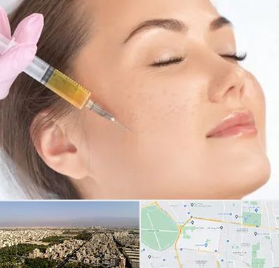 آموزش تزریق ژل و بوتاکس در نازی آباد 