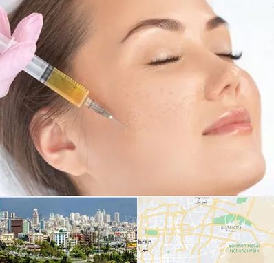 آموزش تزریق ژل و بوتاکس در شرق تهران 