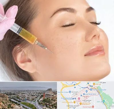 آموزش تزریق ژل و بوتاکس در معالی آباد شیراز 