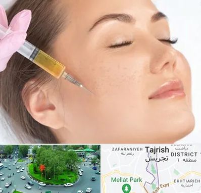 آموزش تزریق ژل و بوتاکس در تجریش 