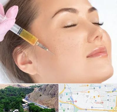 آموزش تزریق ژل و بوتاکس در کن 