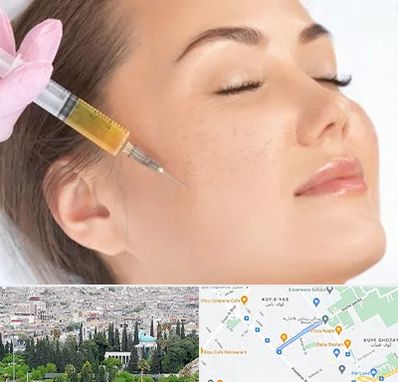 آموزش تزریق ژل و بوتاکس در محلاتی شیراز 