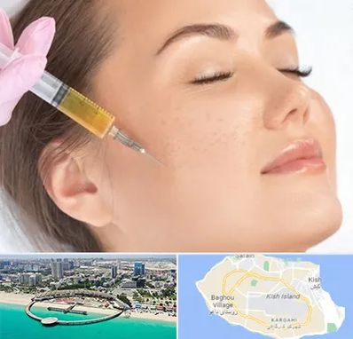 آموزش تزریق ژل و بوتاکس در کیش