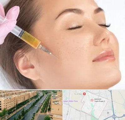 آموزش تزریق ژل و بوتاکس در فاز سه اندیشه