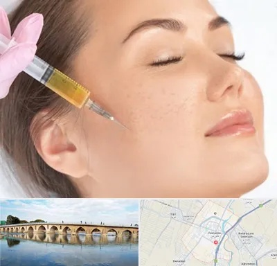 آموزش تزریق ژل و بوتاکس در فلاورجان