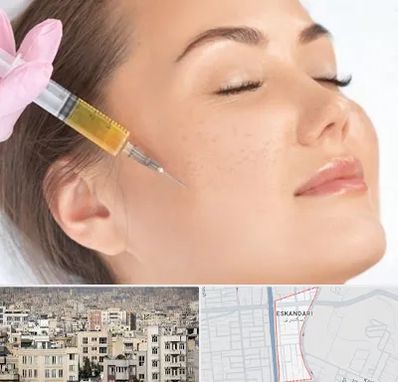 آموزش تزریق ژل و بوتاکس در اسکندری