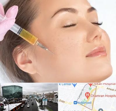 آموزش تزریق ژل و بوتاکس در اقدسیه 