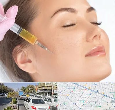 آموزش تزریق ژل و بوتاکس در مفتح مشهد 