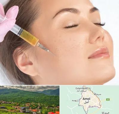 آموزش تزریق ژل و بوتاکس در آمل