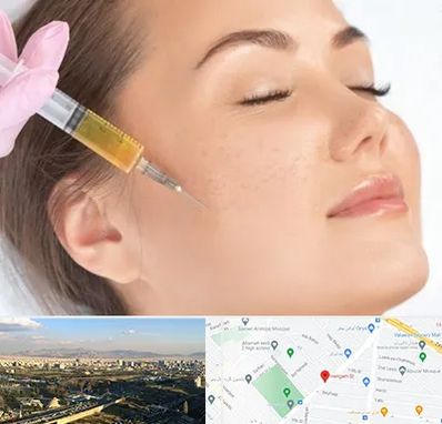 آموزش تزریق ژل و بوتاکس در هنگام 