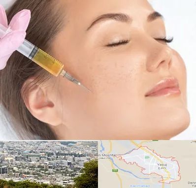 آموزش تزریق ژل و بوتاکس در یاسوج