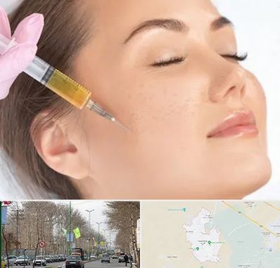 آموزش تزریق ژل و بوتاکس در نظرآباد کرج 