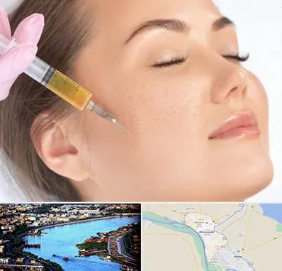 آموزش تزریق ژل و بوتاکس در خرمشهر