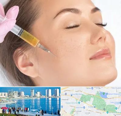 آموزش تزریق ژل و بوتاکس در چیتگر 