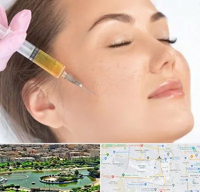 آموزش تزریق ژل و بوتاکس در منطقه 9 تهران