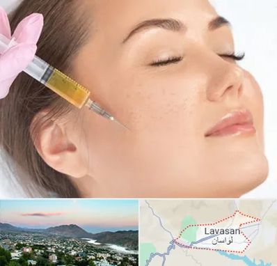 آموزش تزریق ژل و بوتاکس در لواسان