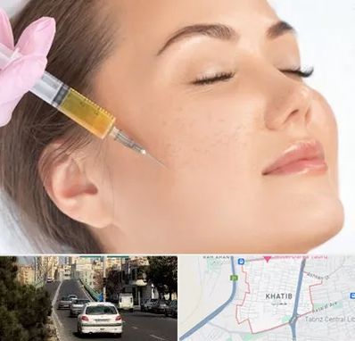 آموزش تزریق ژل و بوتاکس در خطیب تبریز