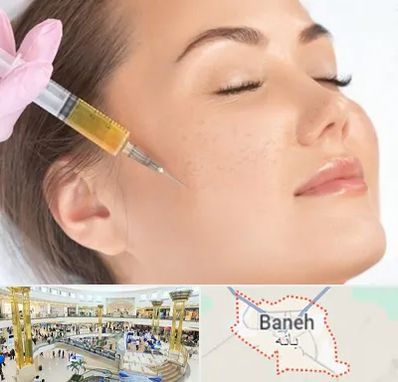 آموزش تزریق ژل و بوتاکس در بانه