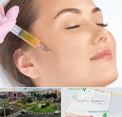 آموزش تزریق ژل و بوتاکس در تهرانسر 