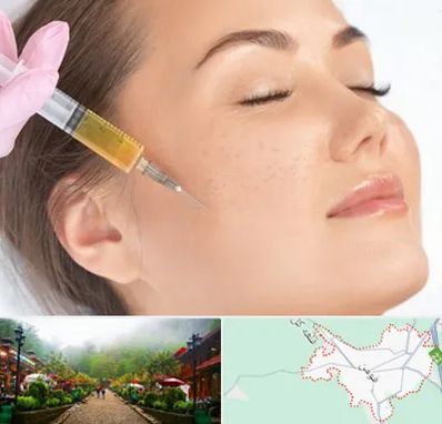 آموزش تزریق ژل و بوتاکس در فومن