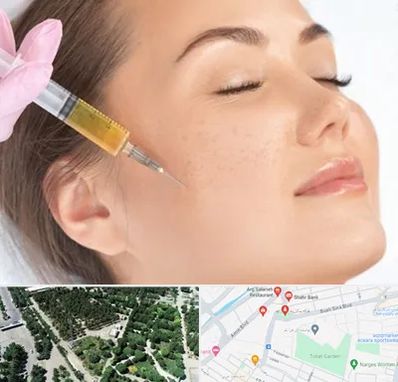 آموزش تزریق ژل و بوتاکس در سالاریه قم