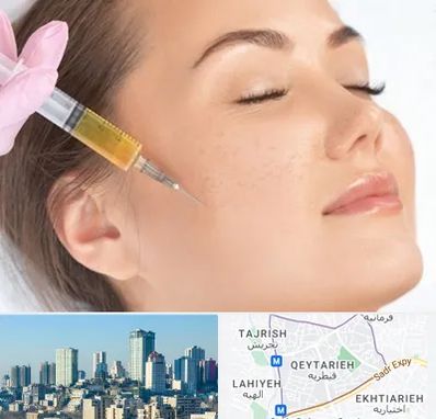 آموزش تزریق ژل و بوتاکس در قیطریه 