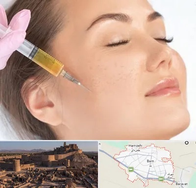 آموزش تزریق ژل و بوتاکس در بم