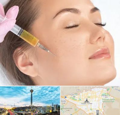 آموزش تزریق ژل و بوتاکس در تهران