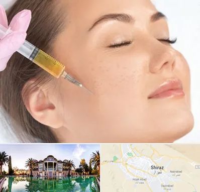 آموزش تزریق ژل و بوتاکس در شیراز