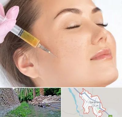 آموزش تزریق ژل و بوتاکس در سراوان