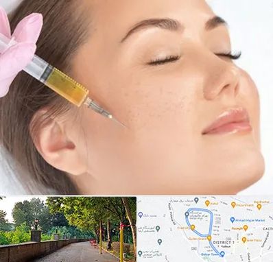 آموزش تزریق ژل و بوتاکس در بلوار گیلان رشت 