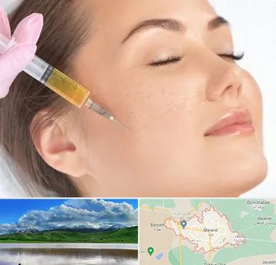 آموزش تزریق ژل و بوتاکس در مرند