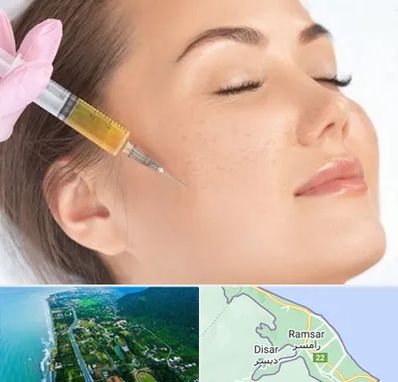 آموزش تزریق ژل و بوتاکس در رامسر