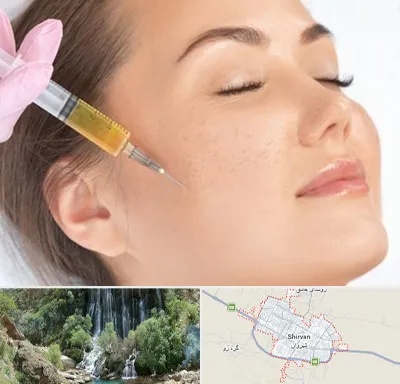 آموزش تزریق ژل و بوتاکس در شیروان