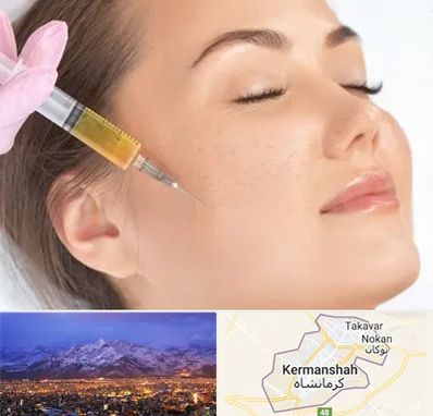آموزش تزریق ژل و بوتاکس در کرمانشاه