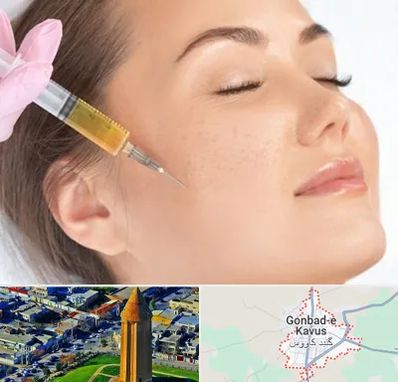 آموزش تزریق ژل و بوتاکس در گنبد کاووس