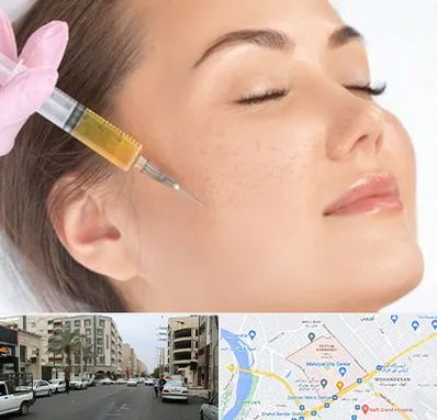 آموزش تزریق ژل و بوتاکس در زیتون کارمندی اهواز 